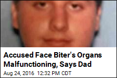 Accused Face Biter's Organs Malfunctioning, Says Dad